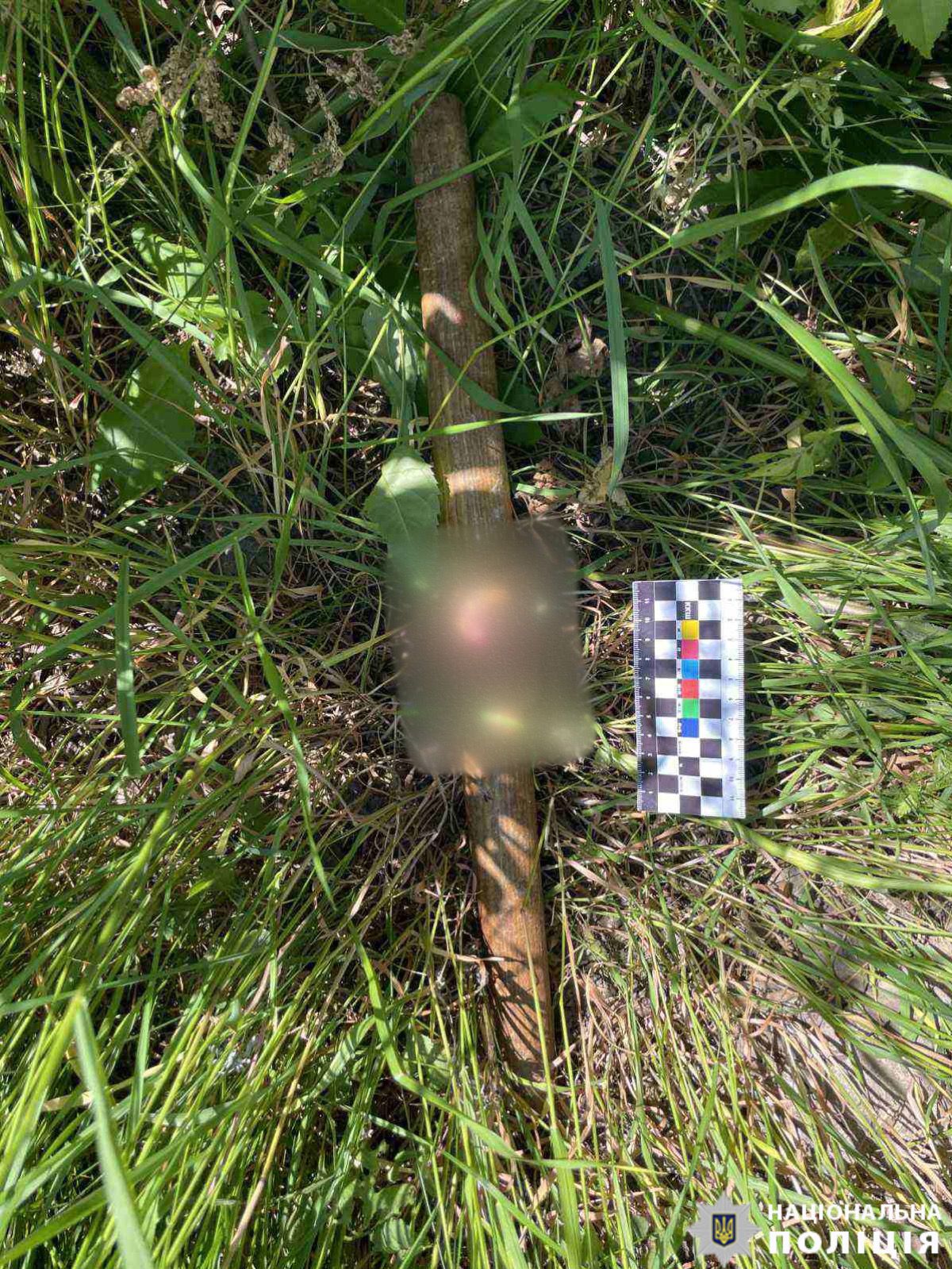 В Винницкой области 48-летняя женщина во время спора нанесла тяжкие телесные повреждения скалкой своему мужу