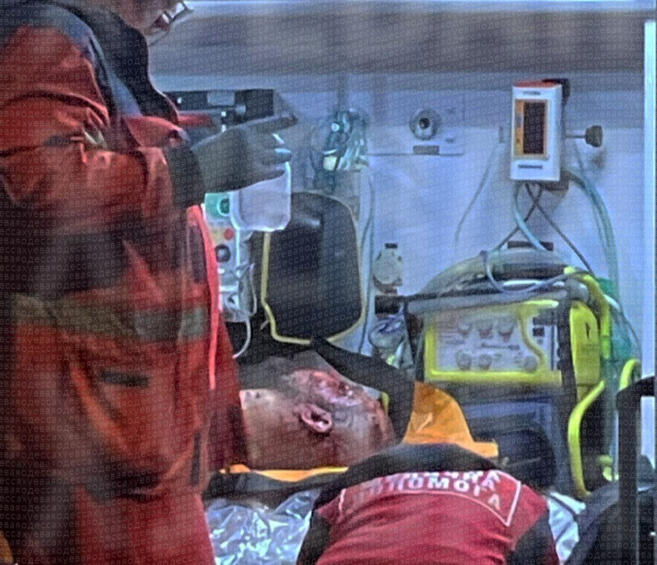 Фото гранати, що постраждав від вибуху, в Одесі. Джерело - Телеграм